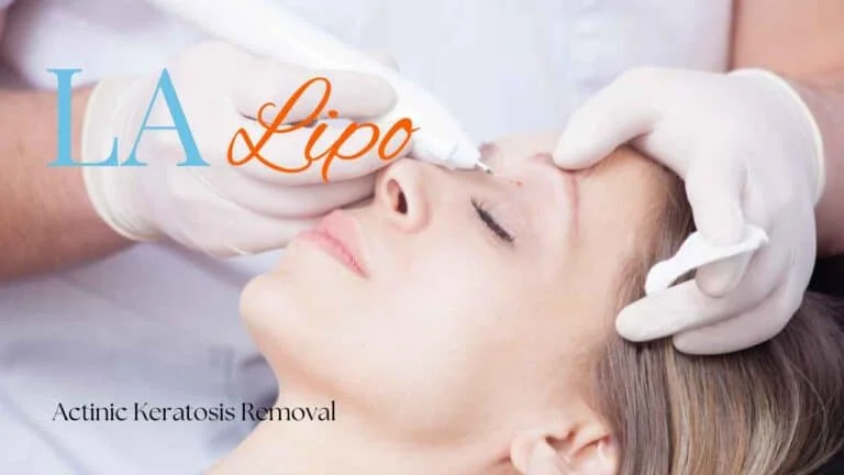 Woman receiving Actinic Keratosis Removal Treatment Acocks Green