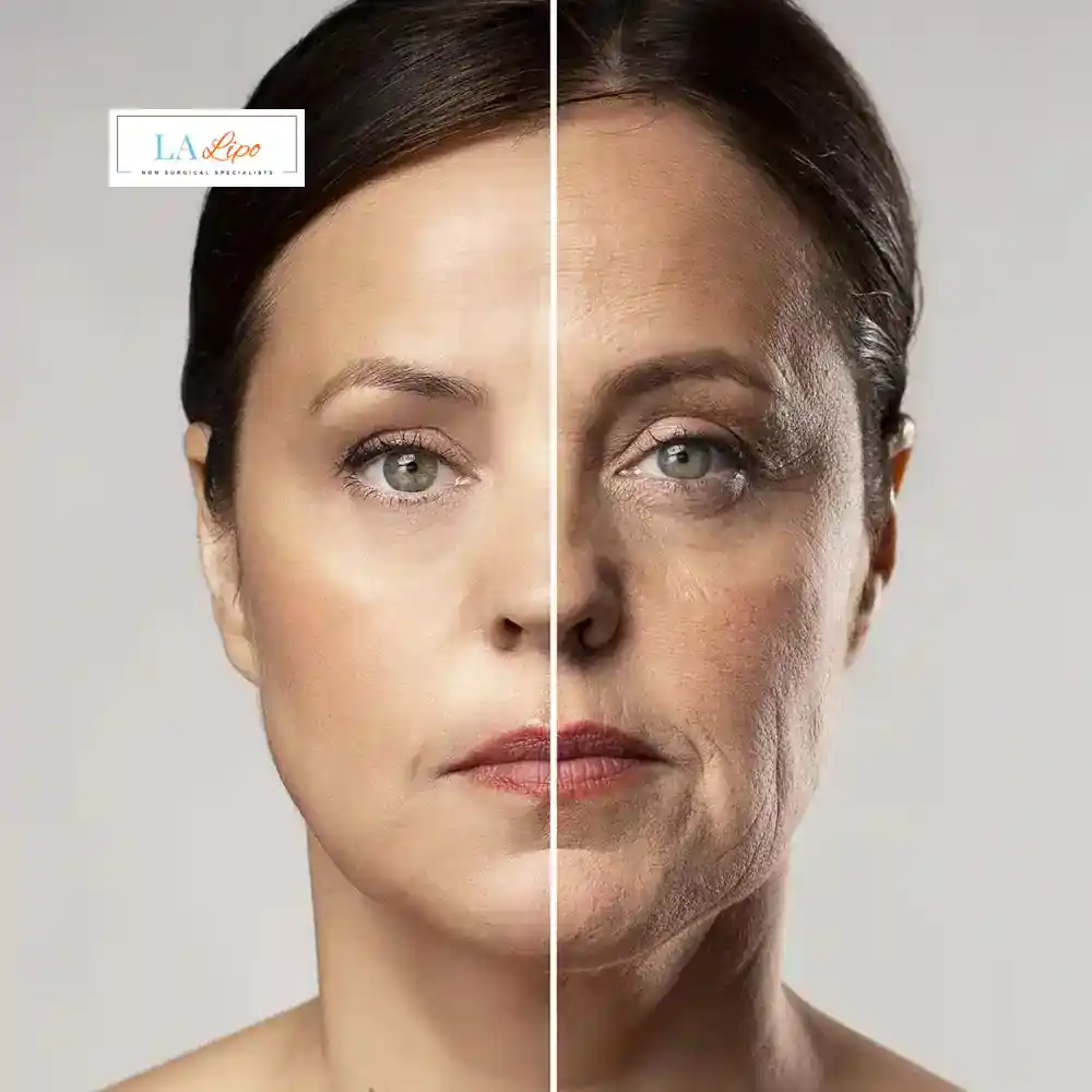 How Can You Tell If Non-Surgical Skin Tightening Is Right for You Acocks Green?