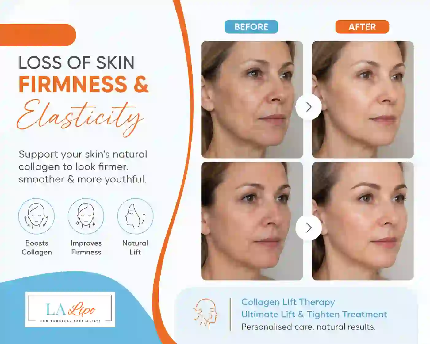Sign #7: Loss of Skin Firmness and Elasticity Acocks Green